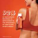 Bio-Oil Skincare Body Oil Serum, Face and Body Moisturizer with Vitamin E & A, for Scars, Stretch Marks, Sensitive Skin, All Skin Types, Dermatologist Recommended, Non-Comedogenic, 6.7 Oz