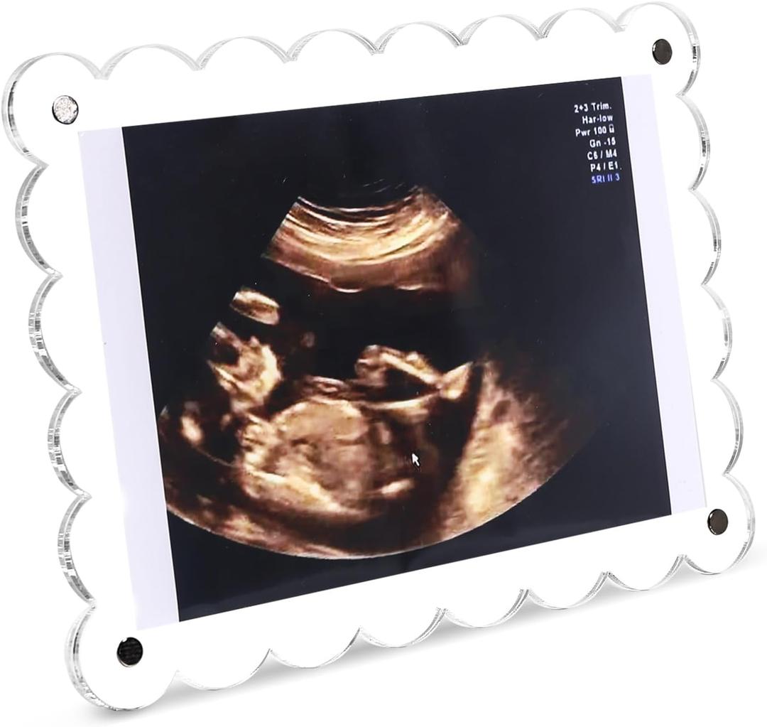 Magnetic Clear Acrylic Scalloped Baby Ultrasound Picture Frame - Sonogram Frame for Refrigerator, Display for Pregnancy Announcement, Gender Reveal & Expecting Parents Gifts(No Stand)