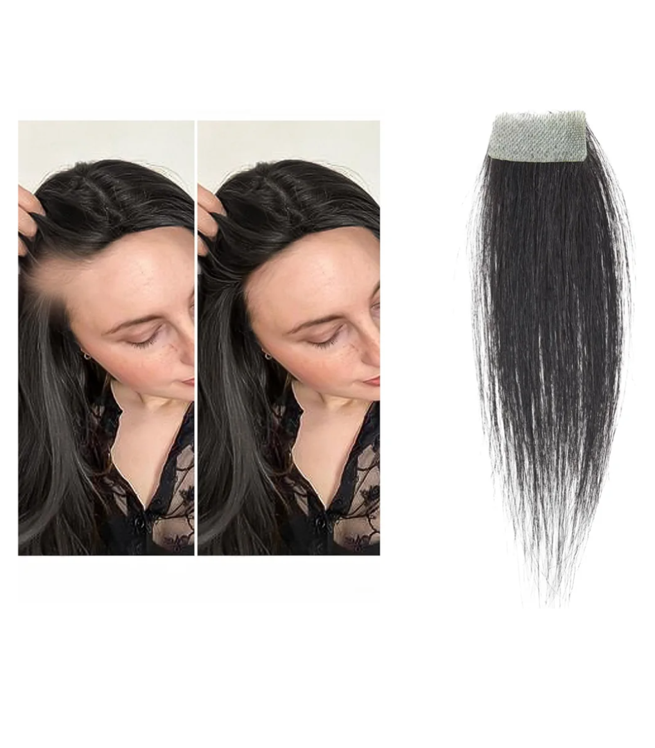 human hair bald spot hair patch toupee scar human hair replacement hairline loss straight Tape for men and women (Natural Black, 0.78"*1.57")