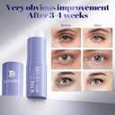 2 x Retinol & Caffeine Eye Balm Stick for Dark Circles, Puffiness, Fine Lines and Eye Bags, Anti Aging Under Eye Cream Smooths Wrinkles Moisture Stick (0.24oz/7g)