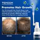 5% Minoxidil Hair Growth Spray for Women and Men, Effective Anti-Hair Loss Treatment for Regrowth, Extra Strength Scalp Solution, Thicker, Stronger and Longer Hair - 60ml
