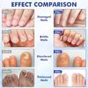 Multi-Purpose Nail Repair, Nail Solution with Tea Tree Oil for Discolored and Damaged NailsPlant Drops for Nails CareDiscolored and Damaged Nails (1PCS) (1 Fl Oz (Pack of 1))