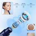 Visual Blackhead Remover Tools with Camera,Pimple Popper Extractor Tool Kit with Camera 20X 1080P Pore Cleaner Acne Comedone Whitehead Extractor Kit for iPhone/Android (Blue)