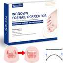 Nitinol Ingrown Toenail Corrector,at Home Ingrown Toenail Treatment,Curved Toenail Straightener,Ingrown Toe Nail Relief，Ingrown Toenail Removal Kit (11/16 In,13/16 In)