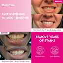 CALLSMILE Whitening Strips for Teeth Sensitive: 64 Strips Gentle Teeth Whitening Strips Enamel Safe Non-Slip Dry Strip Technology Residue Free Daily Oral Care, Mint