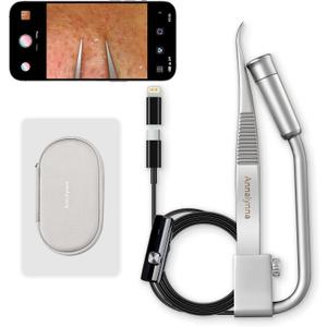 Luma 1 Visual Black Head Remover Tweezers with Camera - Pimple Popper Tweezers with Camera 20x Magnification, 1080P, 8 LED Lights, Dolphin Design Non-Magnetic Tweezers, Pore Cleaner