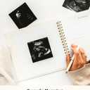 Lamare Pregnancy Journal for First Time Moms Pregnancy Planner, Sonogram Photo Album & Pregnancy Scrapbook for Expecting Moms First Time Mom Gift, Pregnancy Must-Have