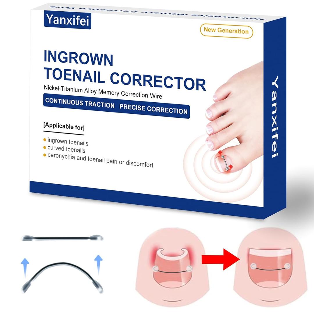 Nitinol Ingrown Toenail Corrector,at Home Ingrown Toenail Treatment,Curved Toenail Straightener,Ingrown Toe Nail ReliefIngrown Toenail Removal Kit (1/2 In,11/16 In)