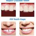 Tooth Repair Kit, Moldable Tooth Filling Repair Kit Beads with 3 Dental Tool, Moldable False Teeth Beads The Missing and Broken Replacements, DIY Natural Filling Fake Teeth,Smile Confidently Again