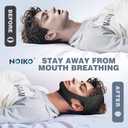 NOIKO Anti Snoring Chin Strap Adjustable, High Elasticity Traceless Chin Strap for Sleeping, Effective Anti Snoring Device, Snore Stopper Breathable and Durable for Adult (Black, XXXL)