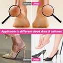 Professional Electric Foot File, Adjustable Rotatable Electronic Foot Dead Skin Remover Callus Remover Tool for Home & Nail Salon with 60 pcs Replacement Sandpaper Disk,Black