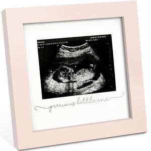 KeaBabies Baby Sonogram Picture Frame - Modern Ultrasound Picture Frames for Mom to Be, First Pregnancy Gifts for Expecting Mom & First Time Dad, Baby Gender Reveal Gifts (Petal Pink)