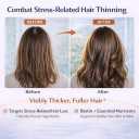Biotin Gummies for Stress Hair Thinning Help Restore Fuller Hair, Stronger Nails & Glowing Skin for Busy Women, Easy Daily Strawberry Gummies, 60 Count