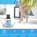 Fast Acting Liquid Wart Corn Callus, Plantar Wart Corn Remover Freeze Off for Feet: Exclusive Formula 17% Salicylic Acid Wart Freeze Off for Plantar Wart, Common Wart, Flat Wart, Corn 30ml.