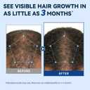 5% Minoxidil for Men Spray: Extra Strength Mens Hair Regrowth Treatment | FAST-DRYING & NON-GREASY | PG-FREE & LOW IRRITATION | GENTLE & SAFE
