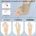 KTSAY 2PCS Bunion Corrector for Women & Men, Big Toe Straightener with Splint & Pads, Comfortable & Breathable for Day/Night Support, Hallux Valgus Pain Relief Non-Slip Socks (1, Beige)