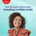 Colgate Baking Soda and Peroxide Whitening Toothpaste Gel, 3 Pack, Fluoride Formulated, Removes Surface Stains, Frosty Mint Stripe, 6 oz
