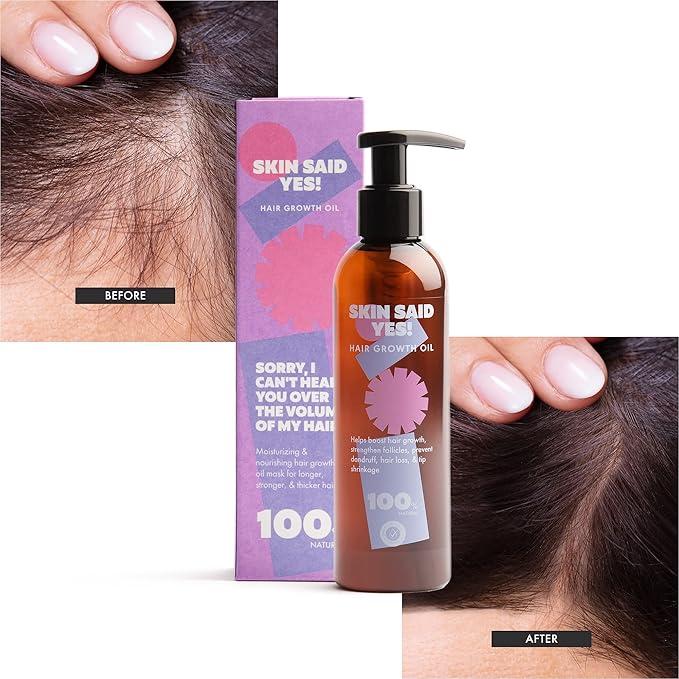 Skin Said Yes Hair Growth and Moisturizing Oil Serum with Natural Oil Blend for Women and Men - Dermatologically Tested, Organic, Vegan-Friendly