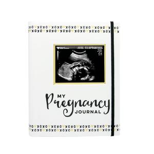 Pearhead My Pregnancy Journal - 74-Page Memory Book and Photo Album, Gender Neutral Planner for Expecting Moms, Includes Milestone Sections and Ultrasound Photo Insert (XOXO)