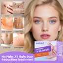 Antaly Silicone Scar Sheets, Silicone Scar Tape, Medical Grade Skin Patches for Surgical Scars, Keloid Bump Removal, C-Section, Stretch Marks, Hypertrophic, Post-Surgery-1.6"X 79" Roll, 2M