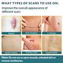 2 x Silicone Scar Tape - 60" x 1.6" Roll - 1.5M, Scar Treatment for Improves Surgical, Keloid, Hypertrophic Scars - Medical Grade Reusable Silicone Scar Sheets (Light)