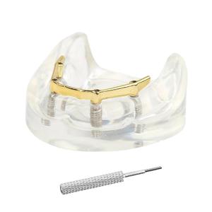 Dental Overdenture Inferior Model 4 Implants Removable Demo Model | For Dentist Education and Study