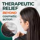 Medicasp Coal Tar Anti-Dandruff Shampoo, Alleviates Symptoms from 1st Wash, Treats Psoriasis, Seborrheic Dermatitis & Itchy Dry Scalp, Fights the Root Cause of Dandruff, Flakes Shampoo, 6 fl oz