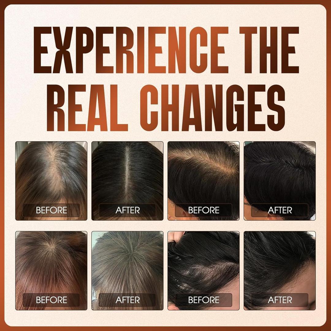 Ginger & He Shou Wu Hair Growth Oil Spray - Infused with Biotin & Castor Oil to Reduce Breakage, Prevent Shedding & Boost Shine - For All Hair Types - 50ml