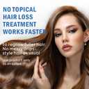Minoxidil for Men and Women Hair Growth: 5% Minoxidil Topical Spray Hair Regrowth Treatment Stop Hair Thinning and Hair Loss For Stronger Thicker Longer Hair 60ml 2 Pack