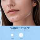 4 x Acne Patches for Face, 36 Count Clear Pimple Stickers, Blemish Cover for Acne