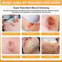 Carbou 4"x 4" Super Absorbent Wound Dressing Pads, 20 Individual Pack, Non Adhesive Absorbent Bandages for Wound Care, Soft Highly Absorbent Dressing, Non Stick Gauze Pads for Wounds