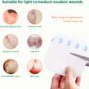 2 x Extra Thin Hydrocolloid Bandages 10 Pack 4" x 4" Large Wound Care Dressing, Self Adhesive Big Waterproof Hydrogel Patch Bandaids Healing for Burn Blister Bedsore Acne Care