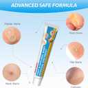 HEALMUSZ Fast-Acting Wart Remover Cream,Salicylic Acid Warts Removal Cream for Men Women, Wart Freeze Off for Feet Hands for Plantar, Flat, Common, Corn, H Warts, Callus 20g