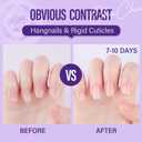 3 x CHUCHU Vegan Cuticle Oil for Nails: Lavender Jojoba Nail Cuticle Oil with Vitamin B & E for Moisturizes Cuticle and Nail's Skin - Prevents Hangnails and Chapped 15ML