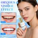 Tooth Polish, 10ml Teeth Whitening Paint, Teeth Paint for Tooth Whitening, Stain Removal and Fresh Breath, Regain Confident Smile (1PC)