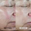 Revision Skincare C+ Correcting Complex 30% Vitamin C Serum for Face Anti-Aging Treatment to Brighten Skin, Reduce Fine Lines, Wrinkles & Dark Spots, Firming & Safe for Sensitive Skin