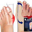 Bunion Corrector for Women Big Toe, Men Too  Ultra-Thin Separator Sock for Bunions. Correction & Pain Relief While You Walk. Splint That Fits in Dress Shoes, Sneakers & Boots. Med-Right