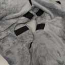 BARKLESS Dog Cone, Inflatable Dog Cone After Surgery for Large Breeds, Soft Surgery Collar with Enhanced Anti-Licking Guard Shield for Pets, Patented Protective Donut Collar (XL (Neck: 18"-23"), Grey)