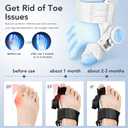 Bunion Corrector for Women Men: Big Toe Straightener Bunion Fix with Adjustable Knob-Orthopedic Bunions Splint Brace Toe Alignment Correction for Hallux Valgus Pain Relief Day/Night 1PCS (Black) (Black)