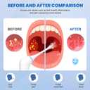 Upgraded Electric Tonsil Stone Remover Gentle Precise and Safe Removal with 3-Type Adjustable Suction & LED Light Food-Grade Material,Rechargeable & Waterproof
