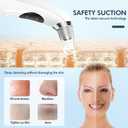 Blackhead Remover Pore Vacuum, Upgraded Black Head Remover for Face, Electric Acne Comedone Whitehead Extractor Tools-5 Suction Power, 5 Probes, USB Rechargeable Pimple Popper Tool Kit