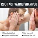 3 x 500 ml Root Activator Shampoo, Hair Growth Root Activator Shampoo, For Anti-Hair Loss, Natural Formula for Men and Women