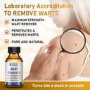 "STAY STOKED" Wart Remover, 15ml Fast-Acting Wart Freeze Off Liquid - The Strongest Wart Remover for Feet, Clinically Proven to Eliminate Stubborn Warts Resistant, Quick-Drying for Daily Use-H5520