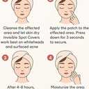 2 x Invisible Acne Patches for Face  Hydrocolloid Acne Patches for Teen Girls & Boys, Best Acne Treatment for Face, Skin Care Stocking Stuffers for Teens, Women & Adults, Invisible Zit Patch