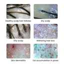 Wireless Skin Analyzer Machine Dermatoscope Scalp/Skin/Hair follicle Detection Testing Analysis Magnifier UV Skin Analyzer Professional 1000X Facial Skin Detector Digital Microscope