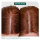 Biolage Scalp Sync Clarifying Shampoo - Residue & Buildup Remover, For Oily Scalp