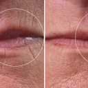 City Beauty City Lips Line Therapy - Lip Line Fortifying Treatment - Defining & Smoothing - Solution for Lipstick Lines, Vertical Wrinkles, Corner Creases - Anti-Aging Cruelty-Free Skin Care