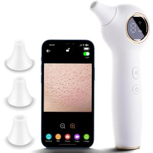 RONEFY Blackhead Extractor with Camera, Black Head Remover for Face,Pore Extractor for Black Head and Acen, Blackhead Remover Tools with USB Rechargeable, Blackhead Remover Vacuum (White)