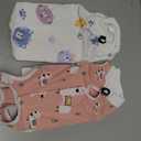 ANWA 2 Pack Cat Recovery Suit - Breathable Cat Onesie for Cats After Surgery Female, Kitten Surgery Recovery Suit Female Abdominal Wounds, Medium