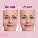 2 x Forehead Wrinkle Patches and Smile Line Patches Set | Hyaluronic Acid Aloe Collagen Vitamin E | Overnight Treatment for Fine Lines Nasolabial Folds and Facial Wrinkles | Non-Invasive Skin-Friendly